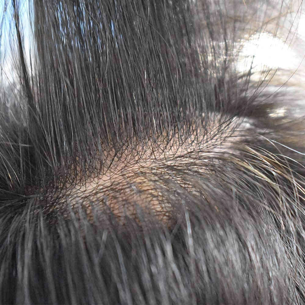 Mens Toupee 0.06mm Ultra Thin Skin Hair Replacement System for Men V-Looped Knots Mens Hairpieces Natural Hairline Toupee for Men